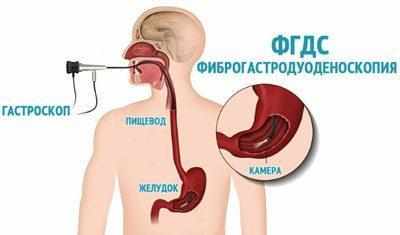 Диагностика фгдс
