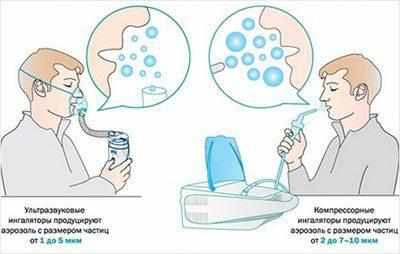 Отличие компрессорного небулайзера от ультразвукового