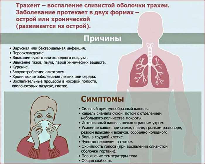 Симптомы и причины трахеита.