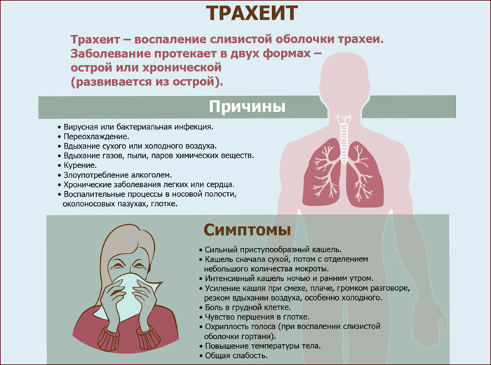 симптоматика трахеита
