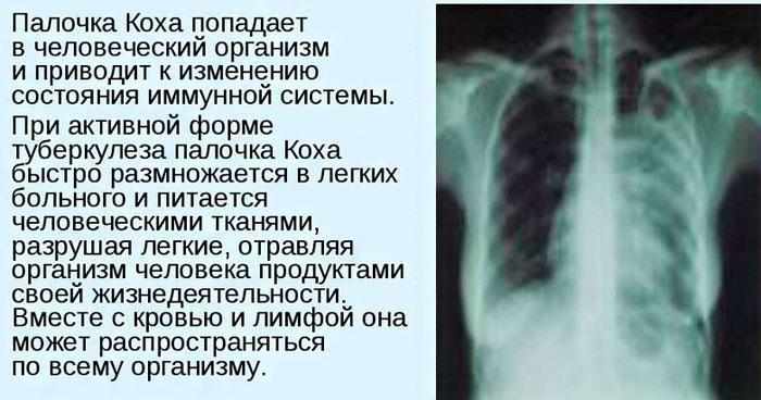 Палочка Коха