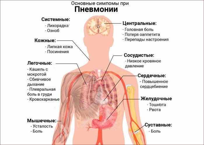 Основные симптомы при пневмонии