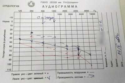 Результат проверки слуха