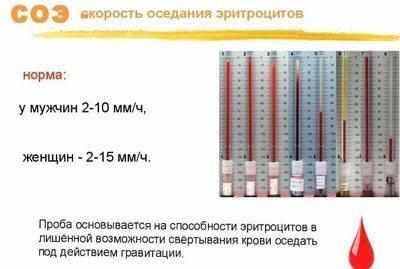 Норма соэ