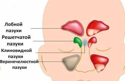 Виды синуситов