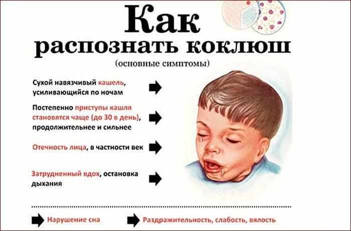 Симптомы коклюша