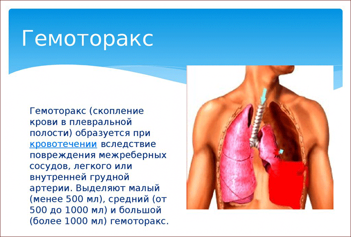 что такое гемоторакс