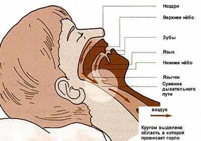 Возникновение храпа