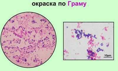 Исследование мокроты