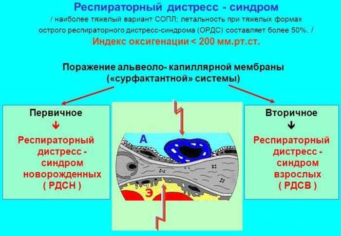 респираторный дистресс-синдром