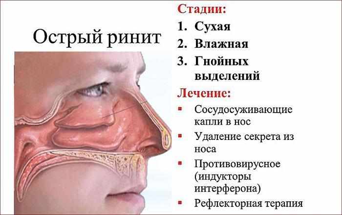 стадии развития ринита