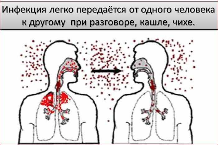 Воздушно-капельный тип передачи инфекции