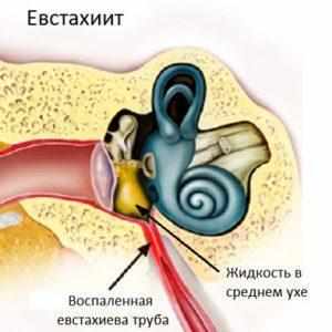 Евстахиит 