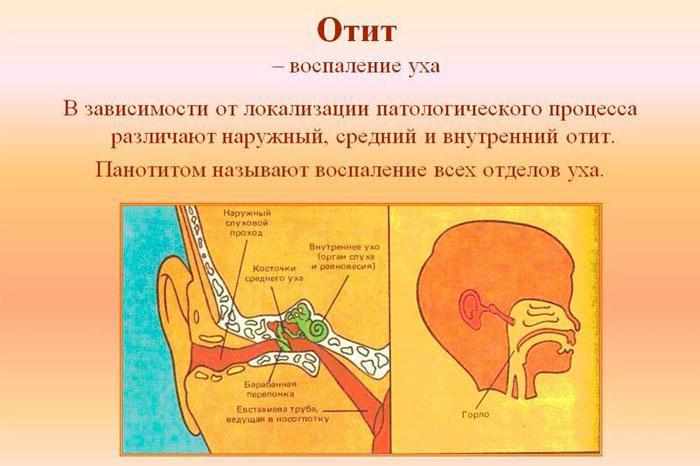 Что такое отит
