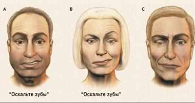 Последствие пареза