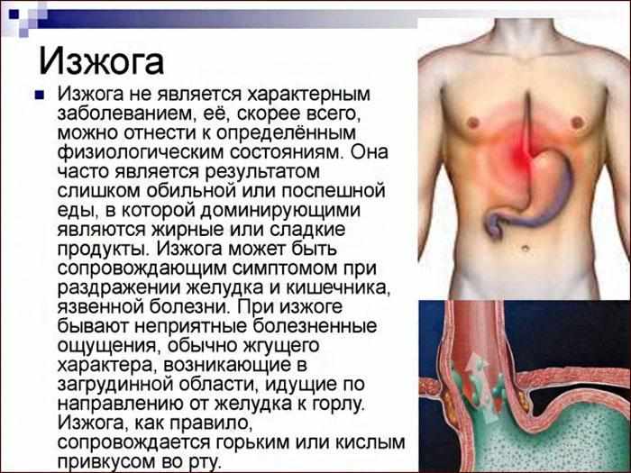 симптомы изжоги