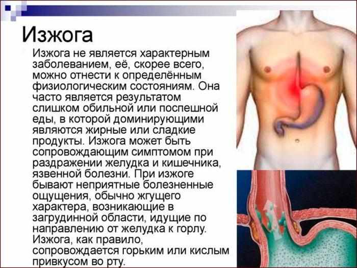 что такое изжога, как проявляется