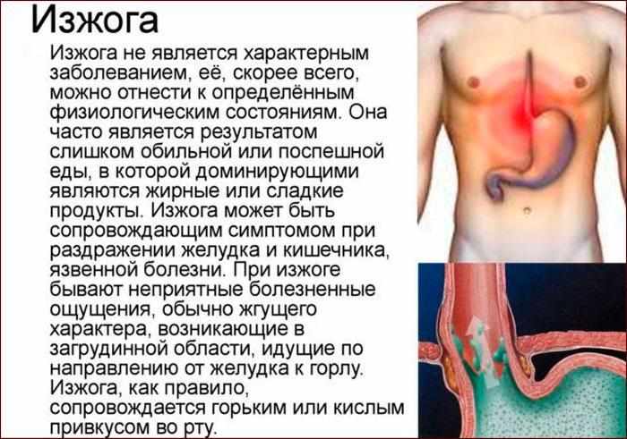 что такое изжога, её проявления