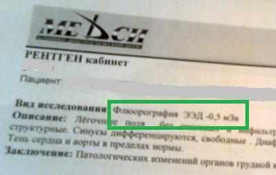 Доза облучения