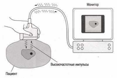 Волны при узи