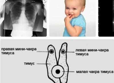 Строение вилочковой железы