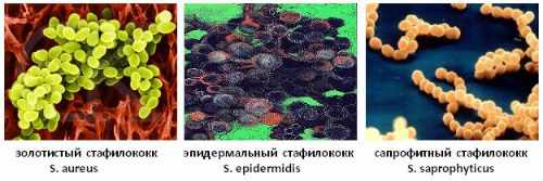 Виды стафилококка