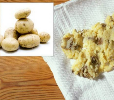 Картофельный компресс