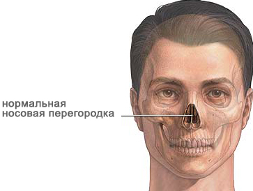 Перегородка в норме