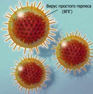 Вирус герпеса