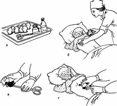 Как правильно ставить банки на спину при кашле взрослому схема