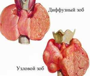 7979