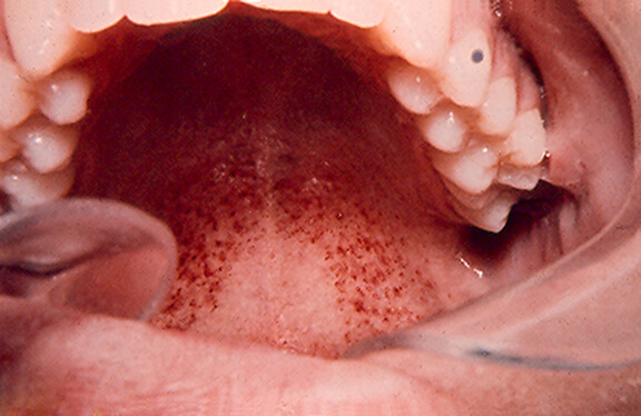 43535