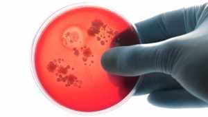 streptococcus