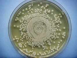virus gerpesa 3 tip
