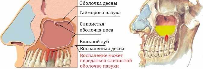 23424