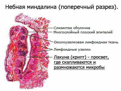 67868