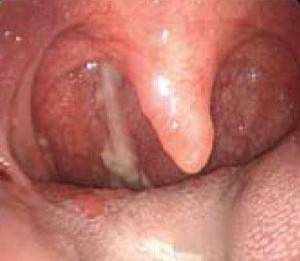 464664