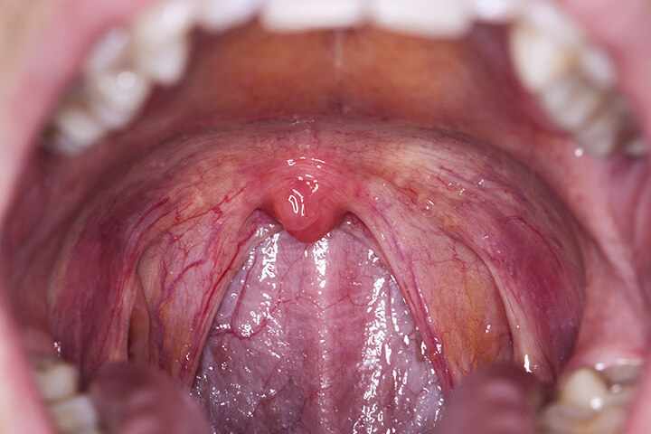 575675