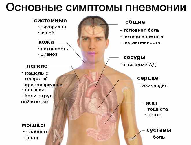 simptomy pnevmonii