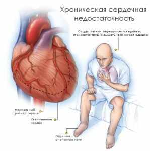 Затрудненное дыхание, одышка и нехватка воздуха от чего бывает?