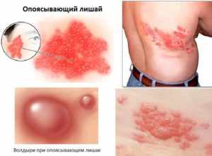 Почему может болеть легкое?