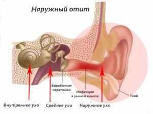 Какие антибиотики принимать при отите у взрослых?