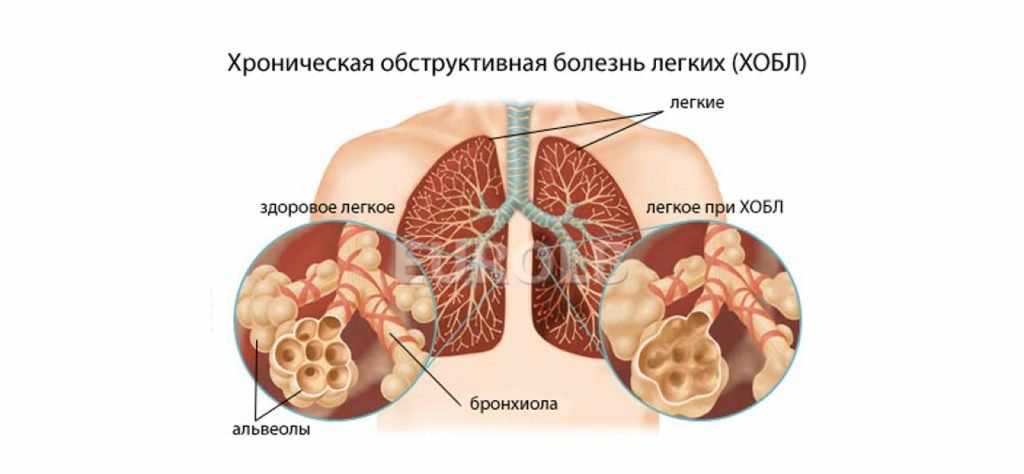 хобл виды