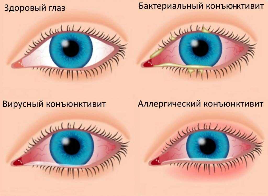 для чего таблетки фурацилин