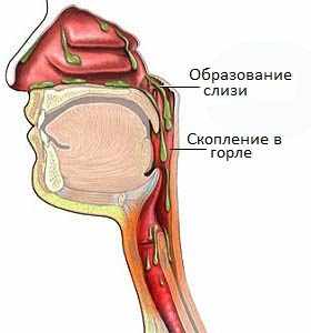 Что делать если у взрослого в горле скапливается слизь как сопли?