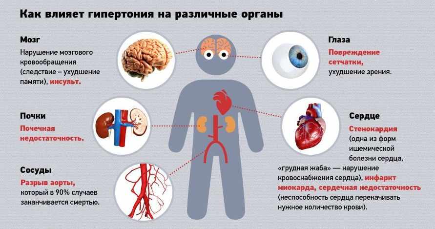 гипертония