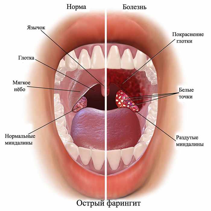 Почему пересыхает в горле?