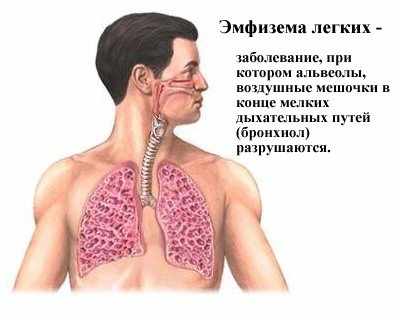 Заболевания органов дыхания и их симптомы