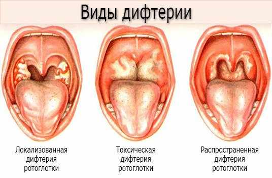Причины приступов удушья в области шеи и горла