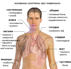 Пневмония что это такое и как ее лечить?